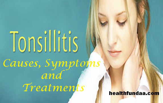 t-tonsillitis - Health Fundaa