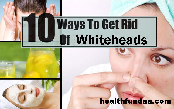 How to Get Rid of Whiteheads: 10 Best Home Remedies